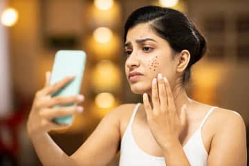 how to stop getting black heads